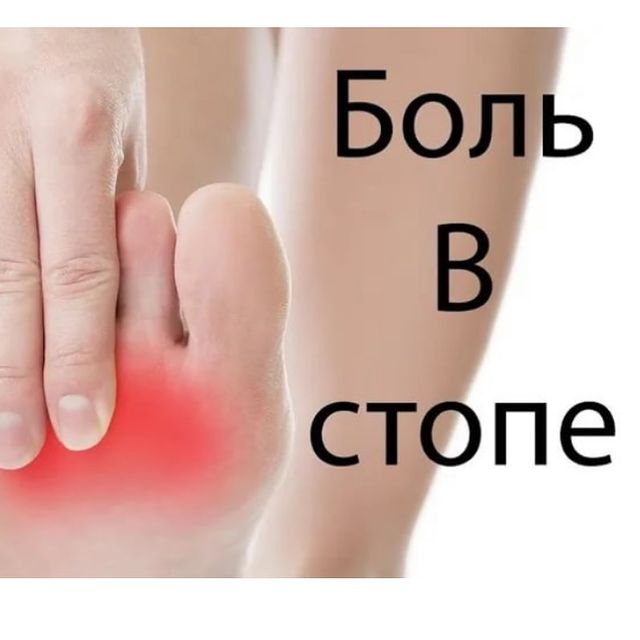 БОЛЬ В СТОПЕ